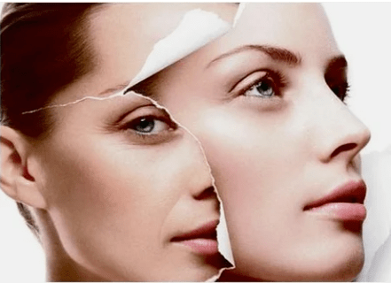 Kontraktor contraindications tina laser rejuvenation rupina