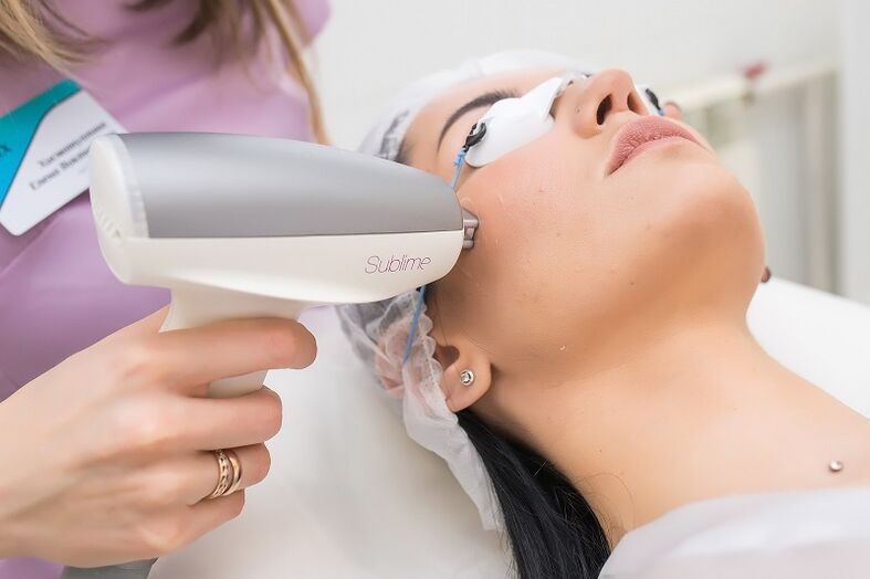 ngalakonan prosedur rejuvenation kulit laser