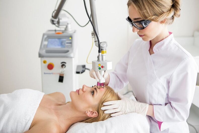 prosedur rejuvenation kulit raray laser