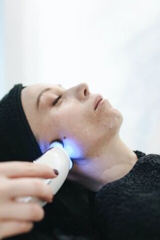 Laser rejuvenation kulit raray
